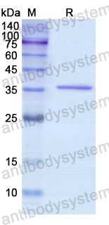 Recombinant Human PDHB Protein, N-His