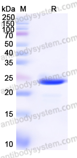 Recombinant Human CD11b/ITGAM Protein, N-His