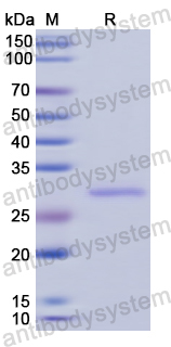 Recombinant Human PYGB Protein, N-His