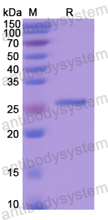 Recombinant Human MBL2 Protein, N-His