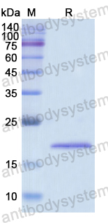 Recombinant Human BCR Protein, N-His