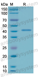 Recombinant Human CD107a/LAMP1 Protein, N-His