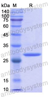 Recombinant Human PIM1 Protein, N-His