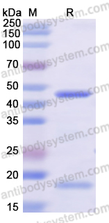 Recombinant Human ACADM Protein, N-His