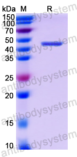 Recombinant Human CD331/FGFR1 Protein, N-His