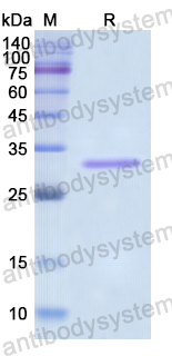 Recombinant Human TOP1 Protein, N-His