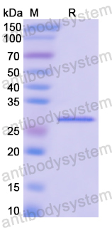 Recombinant Human TOP2A Protein, N-His