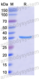 Recombinant Human PSG2 Protein, N-His