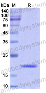 Recombinant Human VDR Protein, N-His