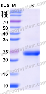 Recombinant Human CYP19A1 Protein, N-His