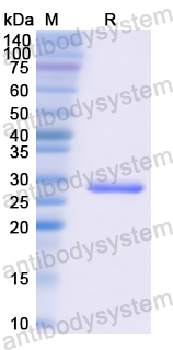 Recombinant Human CETP Protein, N-His