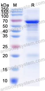 Recombinant Human EPX Protein, N-His