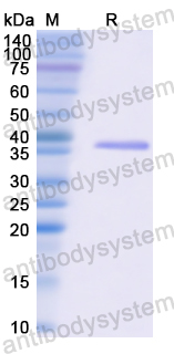 Recombinant Human CDK4 Protein, N-His