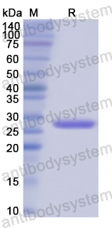 Recombinant Human SRF Protein, N-His