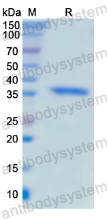 Recombinant Human CD20/MS4A1 Protein, N-His