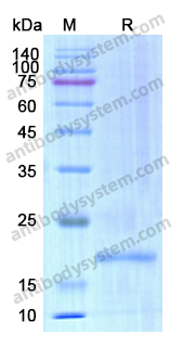 Recombinant Human CD20/MS4A1 Protein, N-His-Trx