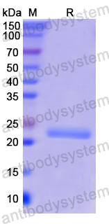 Recombinant Human CD79α/CD79A Protein, N-His