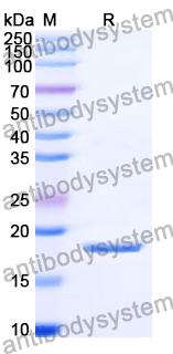 Recombinant Human FGF5 Protein, N-His