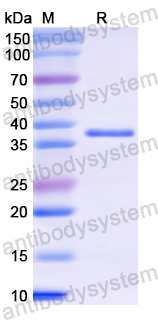 Recombinant Human KRT3 Protein, N-His