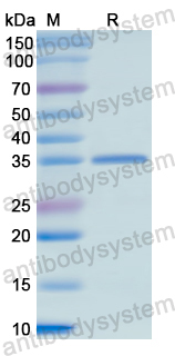 Recombinant Human HARS1 Protein, N-His