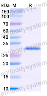 Recombinant Human COL6A1 Protein, N-His