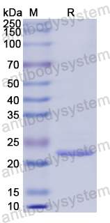 Recombinant Human COL6A3 Protein, N-His