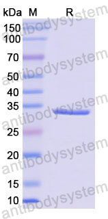 Recombinant Human F5 Protein, N-His