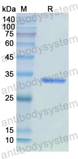 Recombinant Human IMPDH2 Protein, N-His