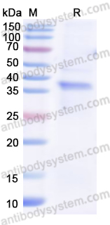 Recombinant Human RLBP1 Protein, N-His