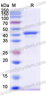 Recombinant Human CKB Protein, N-His