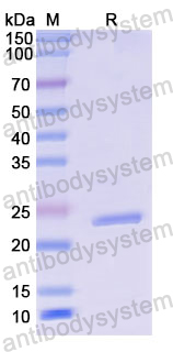 Recombinant Human CD64/FCGR1A Protein, N-His