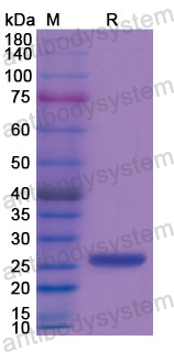 Recombinant Human CKMT1A Protein, N-His