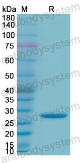 Recombinant Human GZMA Protein, N-His