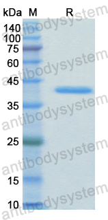 Recombinant Human SRC Protein, N-His