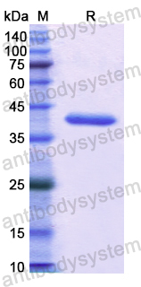 Recombinant Human XRCC5/Ku80 Protein, N-His