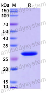 Recombinant Human UNG Protein, N-His