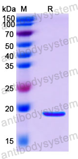 Recombinant Human COX4/COX4I1 Protein, N-His