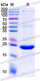 Recombinant Human IL7 Protein, C-His