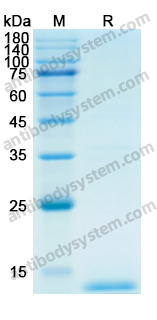 Recombinant Human CCL2/MCP-1 Protein, N-His