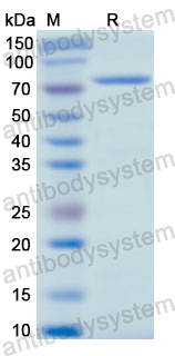 Recombinant Human SCG2 Protein, N-His