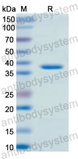 Recombinant Human CD56/NCAM1 Protein, N-His