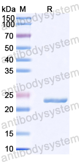 Recombinant Human CD56/NCAM1 Protein, N-His