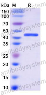 Recombinant Human EEF2 Protein, N-His