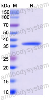 Recombinant Human KRT10 Protein, N-His