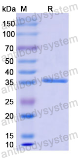 Recombinant Human KRT13 Protein, N-His