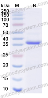 Recombinant Human KRT5 Protein, N-His