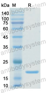 Recombinant Human PDIA4 Protein, N-His