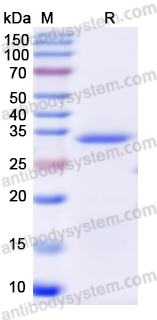 Recombinant Human C6 Protein, N-His