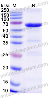 Recombinant Human P4HA1 Protein, N-His