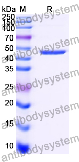 Recombinant Human P4HA1 Protein, N-His